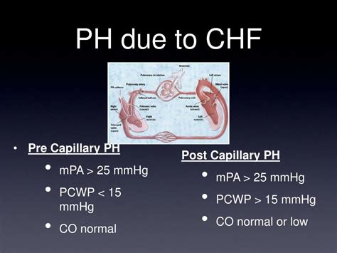 Ppt Pulmonary Hypertension And Congestive Heart Failure Powerpoint