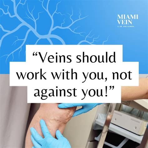 When To Worry About Varicose Veins Miami Vein Center