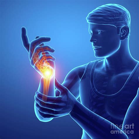 Man With Wrist Pain Photograph By Pixologicstudioscience Photo Library
