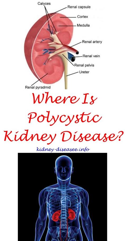 Kidney Location Kidney Disease Kidney Disease Recipes Polycystic