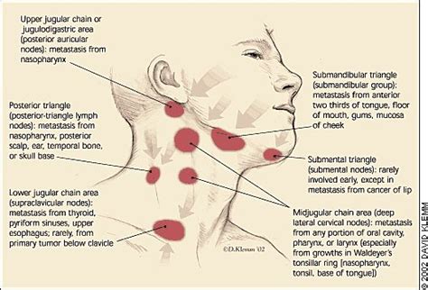 Lymph Nodes The Ojays And Jaw Pain On Pinterest