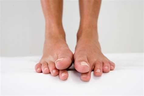 Body Image Do You Hate Your Feet Enough To Get Plastic Surgery On Your