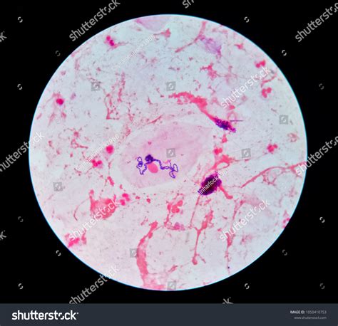 Sputum Gram Stain Shown Many Neutrophils Stock Photo 1050410753