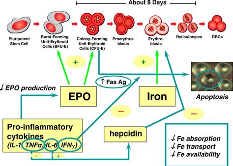 PDF Anemia in renal disease: diagnosis and management ...