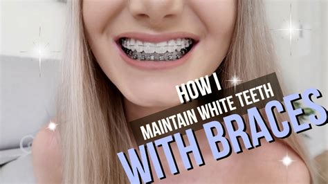 How do teeth stay clean with braces? How I Keep My Teeth White With Braces - YouTube