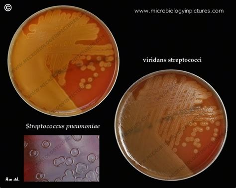 Streptococcus Pneumoniae Colonies Compared With Viridans Streptococci