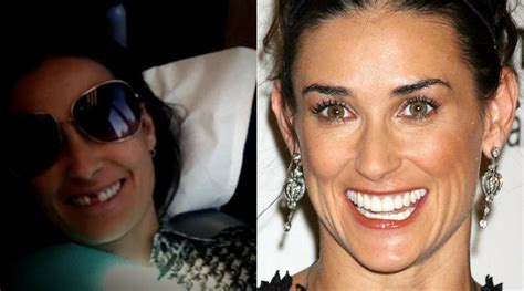 Demi Moore Reveals She S Missing Her Two Front Teeth So How Did It Happen