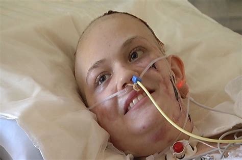 girl who lost 4 limbs to meningitis makes “tremendous progress” nbc