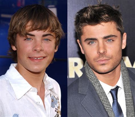 Did Zac Efron Get Plastic Surgery Heres What We Know