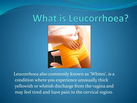 Herbal Treatment For Leucorrhea With Lady Care Capsule Ppt
