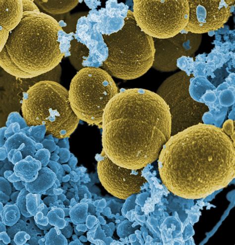 Staphylococcus Aureus And White Blood Cells Scanning Elect Flickr