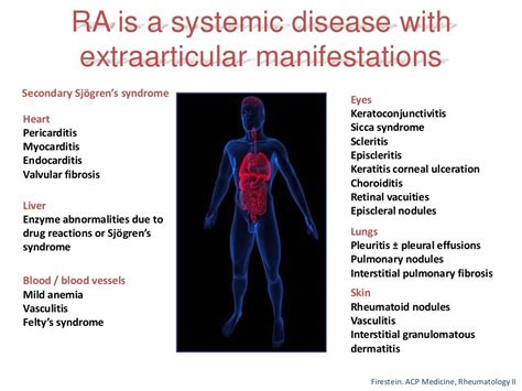 Rheumatoid Arthritis Early Diagnosis And Treatment