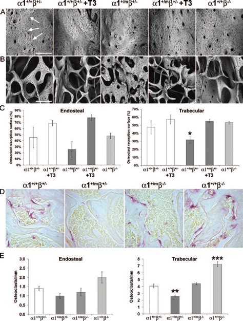 Cortical And Trabecular Bone Surfaces And Osteoclast Numbers In Tr1