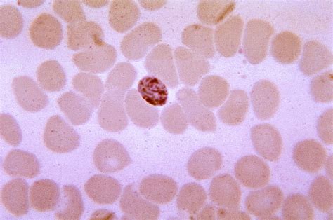 Foto Gratis Immaturi Plasmodium Malariae Schizonte Esposizione