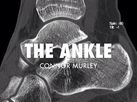 Ankle By Connor Murley