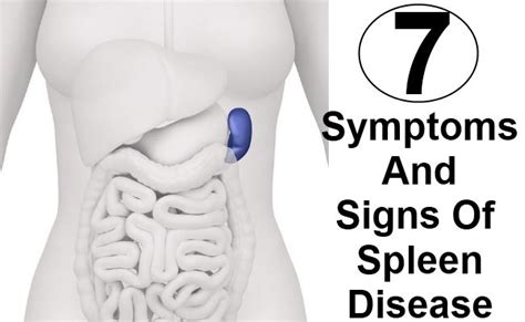 7 Symptoms And Signs Of Spleen Disease Spleen Pain Symptoms Disease