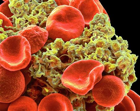 Red Blood Cells And Platelets Photograph By Steve Gschmeissner Pixels