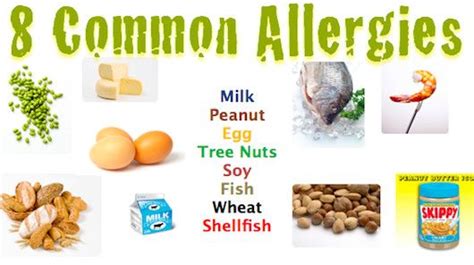 Eight Of The Most Common Allergens Food Allergies Awareness Food
