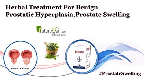 Herbal Treatment For Prostate Swelling Benign Prostatic Hyperplasia Youtube