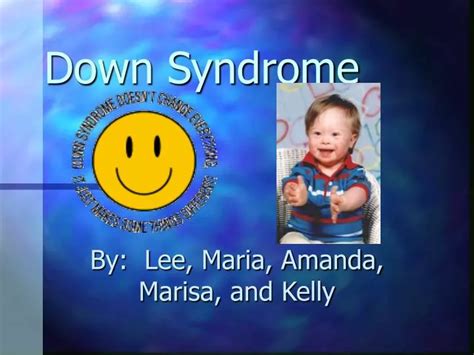 Ppt Down Syndrome Powerpoint Presentation Free Download Id6595328