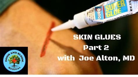 Skin Glues For Wound Closure Part 2 With Dr Joseph Alton Youtube