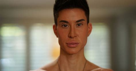 Surgery Obsessed Human Ken Doll Pays £16000 For Bizarre Implants In