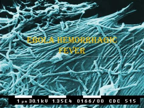 A milder strain of ebola has been discovered in monkeys and pigs in the philippines. PPT - Ebola Hemorrhagic Fever PowerPoint Presentation ...