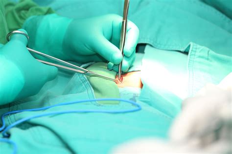 Hernia Repair Complications And Defective Mesh Lawsuits Us Recall News