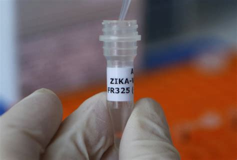 Zika Virus Might Also Spread Via Oral Sex French Researchers Nbc News