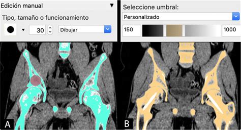 Standard viewing options including mpi are also available. Herramientas de segmentación en Invesalius (Centro de ...