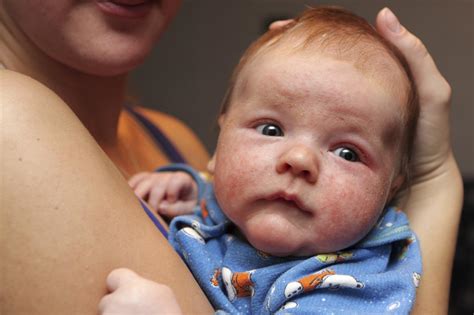 How To Know If Your Baby Has Autism Signs And Symptoms