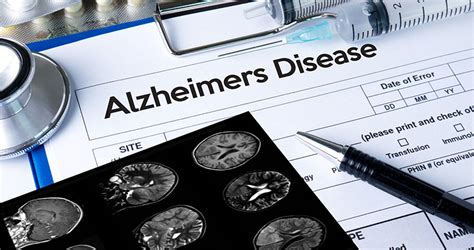 Texas Study Yields New Biomarker Of Alzheimers Disease