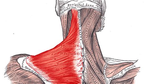Cervical Strain A Common Cause Of Neck And Shoulder Pain Capitol