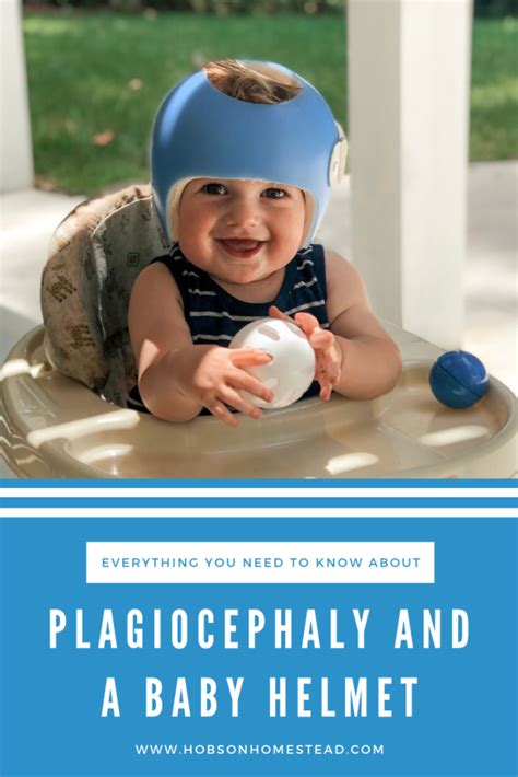 Plagiocephaly And A Baby Helmet Everything You Need To Know Hobson