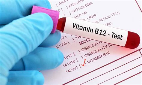 Mungesa E Vitaminës B12 Pasojat Dhe çfarë Të Konsumoni Telegrafi