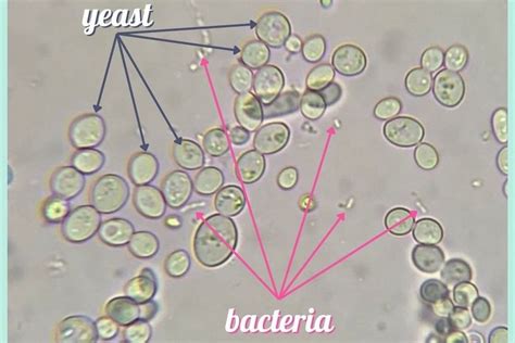 Yeast Vs Bacteria Visual Comparison — Neat
