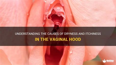 understanding the causes of dryness and itchiness in the vaginal hood medshun