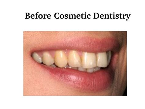 The Best Perfect Smiles Through Cosmetic Dentistry