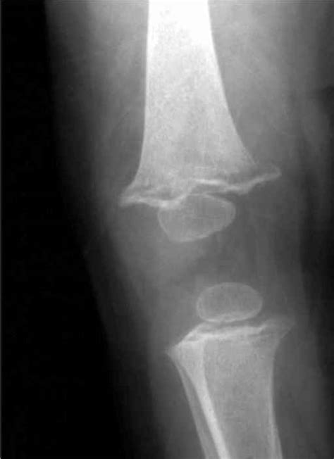Positioning - Forensic Radiology - Barnard Health Care