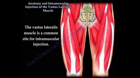 Vastus Lateralis intramuscular Injection - Everything You Need To Know