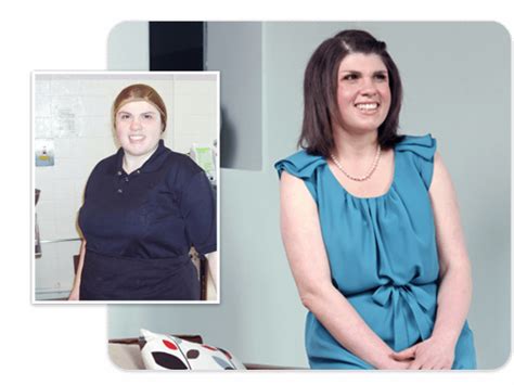 Gastric Band Success Stories Healthier Weight
