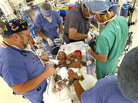 Medical Miracle Conjoined Twins Separated In Memphis Photo 4