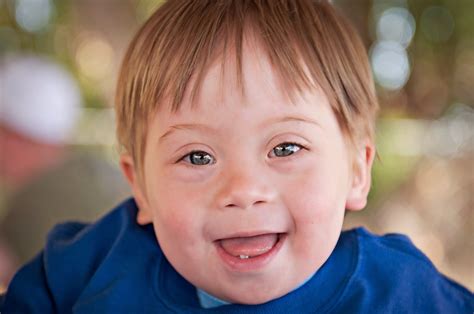 Information on down syndrome genetic disorder that results in varying degrees of physical and mental retardation and likelihood of giving birth to downs child. Science in the News: Down Syndrome