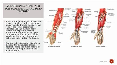 Forearm Compartment Syndrome And Fasciatomy Orthogate