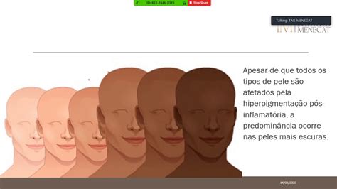 Hiperpigmentação Pós Inflamatória Tem Cura