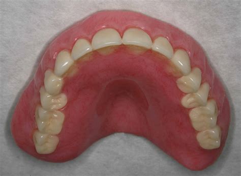 Immediate Dentures Before And After