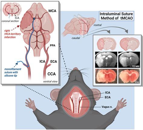 Transient Middle Cerebral Artery Occlusion With An Intraluminal Suture Enables Reproducible