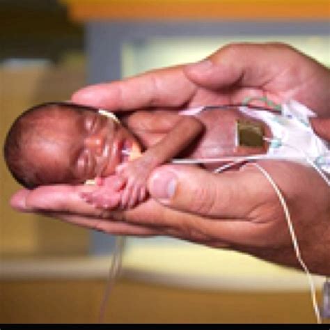 30 Best Images About Premature Babies 22 24 Weeks On Pinterest