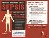 What Is The Medical Condition Sepsis Images