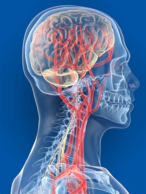 Cerebral Vascular Accident What You Need To Know